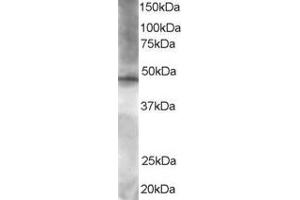 Western Blotting (WB) image for anti-BRF2, Subunit of RNA Polymerase III Transcription Initiation Factor, BRF1-Like (BRF2) (C-Term) antibody (ABIN184848)