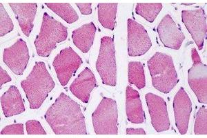 Immunohistochemistry (IHC) image for anti-ATP Synthase, H+ Transporting, Mitochondrial F1 Complex, O Subunit (ATP5O) (AA 38-64) antibody (ABIN1804557)