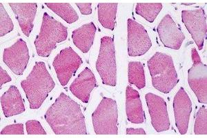 Human Skeletal Muscle: Formalin-Fixed, Paraffin-Embedded (FFPE) (ATP5O 抗体  (AA 38-64))