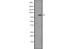 Western blot analysis of ZBTB16 expression in HL60 (Human promyelocytic leukemia cell line) Whole Cell Lysate,The lane on the left is treated with the antigen-specific peptide. (ZBTB16 抗体  (Internal Region))