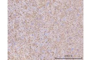 IHC analysis of PTN using anti-PTN antibody (ABIN7602164). (Pleiotrophin 抗体  (AA 61-148))