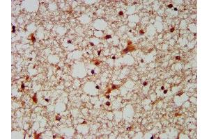 IHC image of ABIN7148695 diluted at 1:300 and staining in paraffin-embedded human brain tissue performed on a Leica BondTM system. (MUS81 抗体  (AA 82-265))