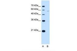 PIGV 抗体  (AA 51-100)