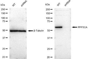 Western blotting analysis using PPP3CA antibody (ABIN7800026). (Recombinant PPP3CA 抗体)