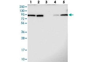 Western blot analysis of Lane 1: RT-4, Lane 2: U-251 MG, Lane 3: Human Plasma, Lane 4: Liver, Lane 5: Tonsil with TBL3 polyclonal antibody  at 1:100-1:250 dilution. (TBL3 抗体)