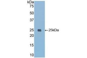 Western Blotting (WB) image for anti-Insulin-Like Growth Factor Binding Protein 7 (IGFBP7) (AA 88-281) antibody (ABIN7433918)