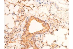 ABIN6267289 at 1/100 staining mouse lung tissue sections by IHC-P. (p53 抗体  (pSer15))
