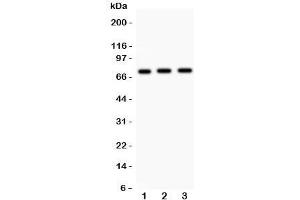 Western blot testing of Myb antibody and human samples 1:  placenta;  2: SMMC-7721;  3: HeLa lysate. (MYB 抗体  (AA 1-201))