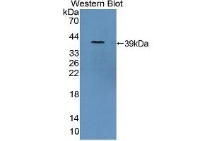 Detection of Recombinant GCPII, Porcine using Polyclonal Antibody to Prostate-specific Membrane Antigen (PMSA) (PSMA 抗体  (AA 275-588))