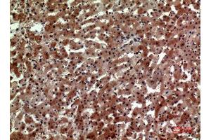 Immunohistochemistry (IHC) analysis of paraffin-embedded Human Liver, antibody was diluted at 1:100. (CD163L1 抗体  (Internal Region))