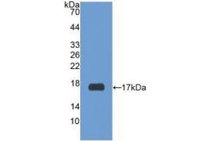Detection of Recombinant RXFP1, Human using Polyclonal Antibody to Relaxin/Insulin Like Family Peptide Receptor 1 (RXFP1) (RXFP1 抗体  (AA 260-409))