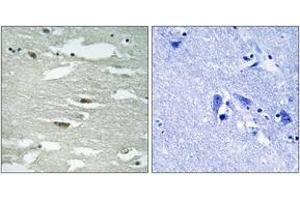 Immunohistochemistry analysis of paraffin-embedded human brain, using ILK (Phospho-Ser246) Antibody.