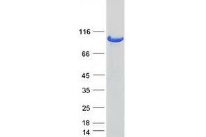 Western Blotting (WB) image for Ubiquitin Specific Peptidase 13 (Isopeptidase T-3) (USP13) protein (Myc-DYKDDDDK Tag) (ABIN2712394)