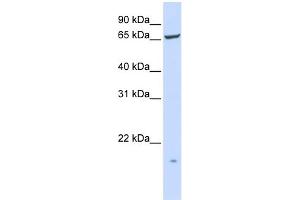 WB Suggested Anti-PIGT Antibody Titration:  0. (PIGT 抗体  (N-Term))