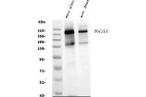 Western blot analysis of NUP214 using anti-NUP214 antibody (ABIN7601473). (NUP214 抗体  (AA 36-374))
