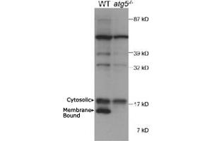 Western blot analysis of autophagic MAP1LC3A in mouse ES cell lysate using MAP1LC3A polyclonal antibody . (MAP1LC3A 抗体  (AA 50-150))