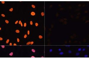 Immunofluorescence analysis of NIH/3T3 cells using Acetyl-Histone H3-K4 Polyclonal Antibody at dilution of 1:100.