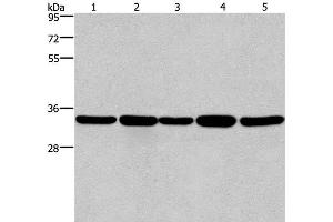 Western Blot analysis of LoVo and A549 cell, Human hepatocellular carcinoma tissue, Jurkat and Hela cell using E2F6 Polyclonal Antibody at dilution of 1:650 (E2F6 抗体)