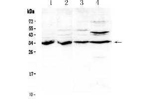 Western blot analysis of BRMS1 using anti- BRMS1 antibody . (BRMS1 抗体  (AA 52-244))