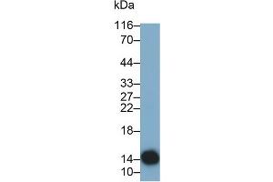 Detection of CST4 in Human Saliva using Monoclonal Antibody to Cystatin 4 (CST4) (CST4 抗体  (AA 21-141))