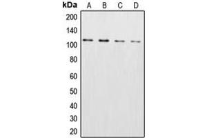 Western blot analysis of XPO2 expression in HeLa (A), NIH3T3 (B), SP2/0 (C), PC12 (D) whole cell lysates. (Exportin 2 抗体  (N-Term))