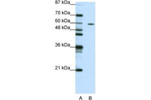 Western Blotting (WB) image for anti-Zinc Finger Protein 382 (ZNF382) antibody (ABIN2461958) (ZNF382 抗体)