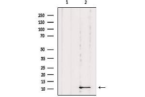Western Blotting (WB) image for anti-Dynein, Light Chain, Roadblock Type 1 (DYNLRB1) (Internal Region) antibody (ABIN6261395)