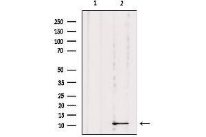 Western blot analysis of extracts from Mouse Myeloma cell, using DYNLRB1 Antibody.