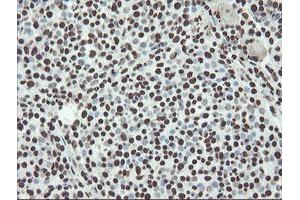 Image no. 9 for anti-Non-POU Domain Containing, Octamer-Binding (NONO) (AA 184-385) antibody (ABIN1491073)