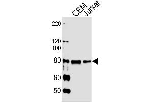 Lane 1: CEM cell lysates, Lane 2: Jurkat cell lysates probed with MYB (1279CT309. (MYB 抗体)