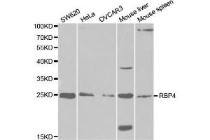 Western blot analysis of extracts of various cell lines, using RBP4 antibody (ABIN5970777) at 1/1000 dilution. (RBP4 抗体)