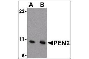 Western blot analysis of PEN2 in A-20 cell lysate with this product at (A) 0. (PEN2 抗体  (N-Term))