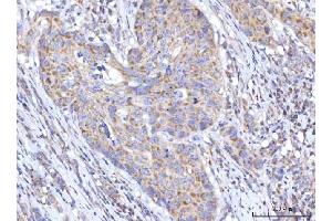 IHC analysis of C18orf22/RBFA using anti-C18orf22/RBFA antibody (ABIN7600106).