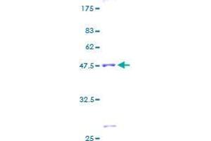 ASF1B Protein (AA 1-202) (GST tag)