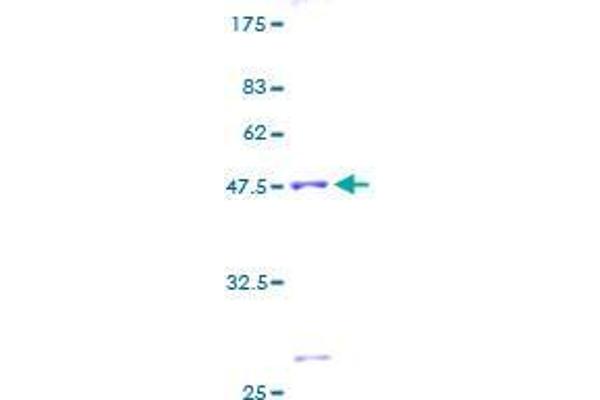 ASF1B Protein (AA 1-202) (GST tag)