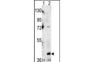 Western blot analysis of P38 (arrow) using P38 Antibody (C-term) (ABIN1882176 and ABIN2841644). (MAPK14 抗体  (C-Term))