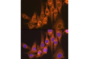 Immunofluorescence analysis of NIH-3T3 cells using Rap1GAP Rabbit mAb (ABIN1680949, ABIN3017895, ABIN3017896 and ABIN7101534) at dilution of 1:100 (40x lens). (RAP1GAP 抗体)