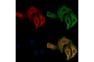 ABIN7093362 and ABIN7097382 staining Hela cells by IF/ICC. (TOMM22 抗体)