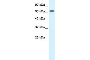 Western Blotting (WB) image for anti-Potassium Intermediate/small Conductance Calcium-Activated Channel, Subfamily N, Member 2 (KCNN2) (C-Term) antibody (ABIN630068)