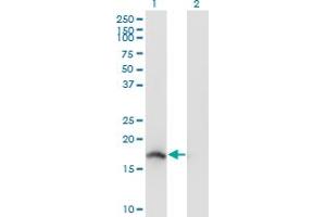 Western Blot analysis of NENF expression in transfected 293T cell line by NENF monoclonal antibody (M04), clone 7D10. (Neudesin 抗体  (AA 1-172))