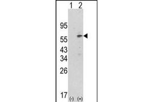 Western blot analysis of PDK1 (arrow) using rabbit polyclonal hPDK1-G14 (ABIN391036 and ABIN2841202). (PDPK1 抗体  (N-Term))