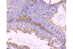 Immunohistochemistry (Paraffin-embedded Sections) (IHC (p)) image for anti-Signal Transducer and Activator of Transcription 5B (STAT5B) antibody (ABIN5557344)