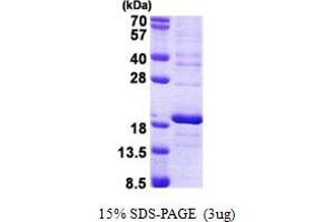 SDS-PAGE (SDS) image for Ribosomal Protein S16 (RPS16) (AA 1-146) protein (His tag) (ABIN7280351)