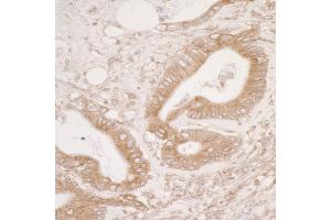 Immunohistochemistry (IHC) image for anti-Protein Disulfide Isomerase Family A, Member 3 (PDIA3) (AA 50-100) antibody (ABIN7453944) (PDIA3 抗体  (AA 50-100))