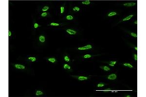 Immunofluorescence of monoclonal antibody to OXSR1 on HeLa cell. (OXSR1 抗体  (AA 351-450))