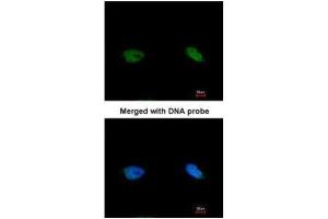 ICC/IF Image Immunofluorescence analysis of paraformaldehyde-fixed HeLa, using BCCIP , antibody at 1:200 dilution.