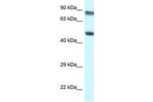 Image no. 1 for anti-Pseudouridylate Synthase 1 (PUS1) (AA 88-137) antibody (ABIN6747496) (PUS1 抗体  (AA 88-137))