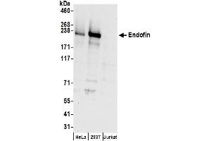 anti-Zinc Finger, FYVE Domain Containing 16 (ZFYVE16) (AA 825-875) antibody