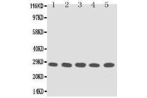 Anti-TFPI2 antibody, Western blotting Lane 1: MM453 Cell Lysate Lane 2: MM231 Cell Lysate Lane 3: HELA Cell Lysate Lane 4:  Cell Lysate Lane 5: JURKAT Cell Lysate (TFPI2 抗体  (Middle Region))
