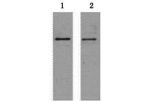 Western Blot analysis of 2 μg S-Tag fusion protein using S-Tag Monoclonal Antibody at dilution of 1) 1:5000 2) 1:10000. (S-Tag 抗体)